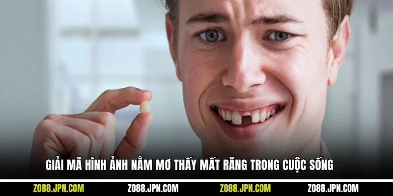 Giải mã hình ảnh nằm mơ thấy mất răng trong cuộc sống